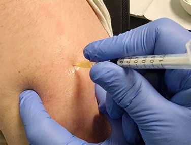 Oltas_Belgium_211201_3_1200